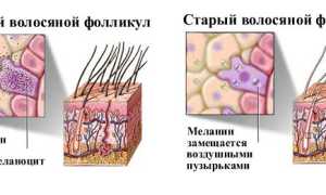 Седые волосы: причины, профилактика и лечение