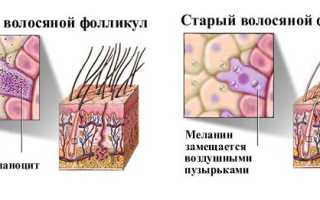 Седые волосы: причины, профилактика и лечение
